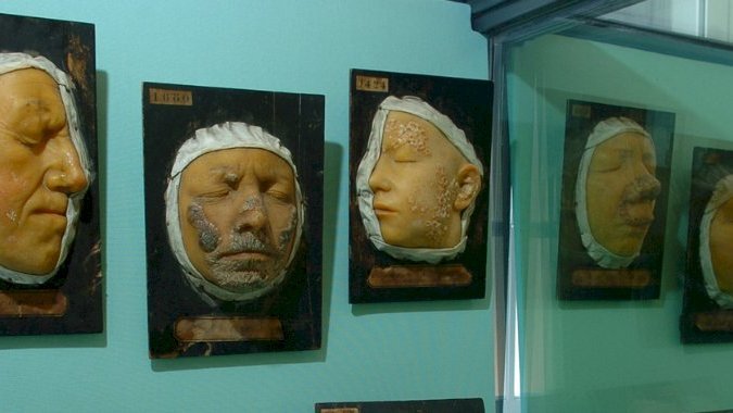 Musée Des Instruments De Médecine Des Hôpitaux De Toulouse Le Musée des instruments de médecine des hôpitaux de Toulouse, un