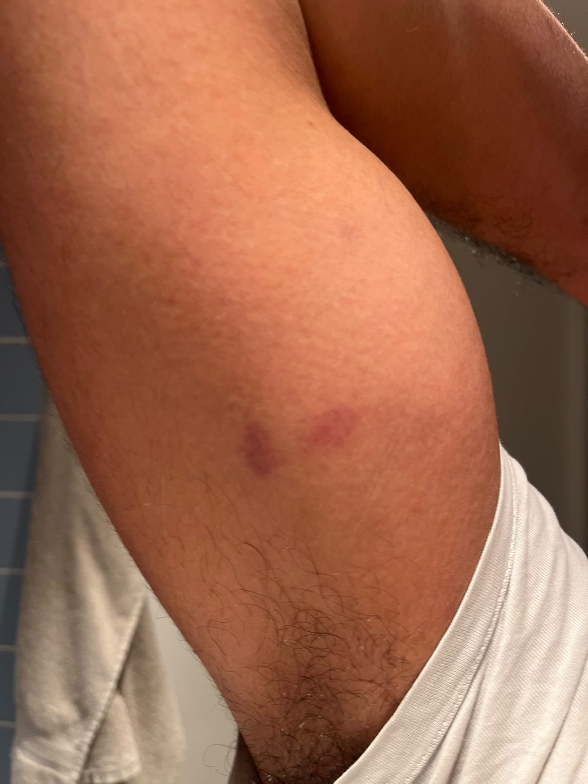 blessures-expulsion-concert-lady-gaga-lyon-ldlc-arena