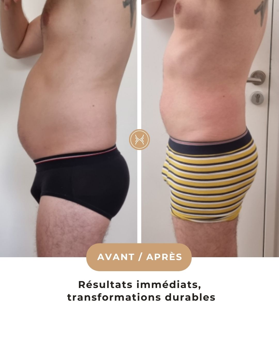 avant-apres-protocole-stop-ballonement-coolfit-lyon