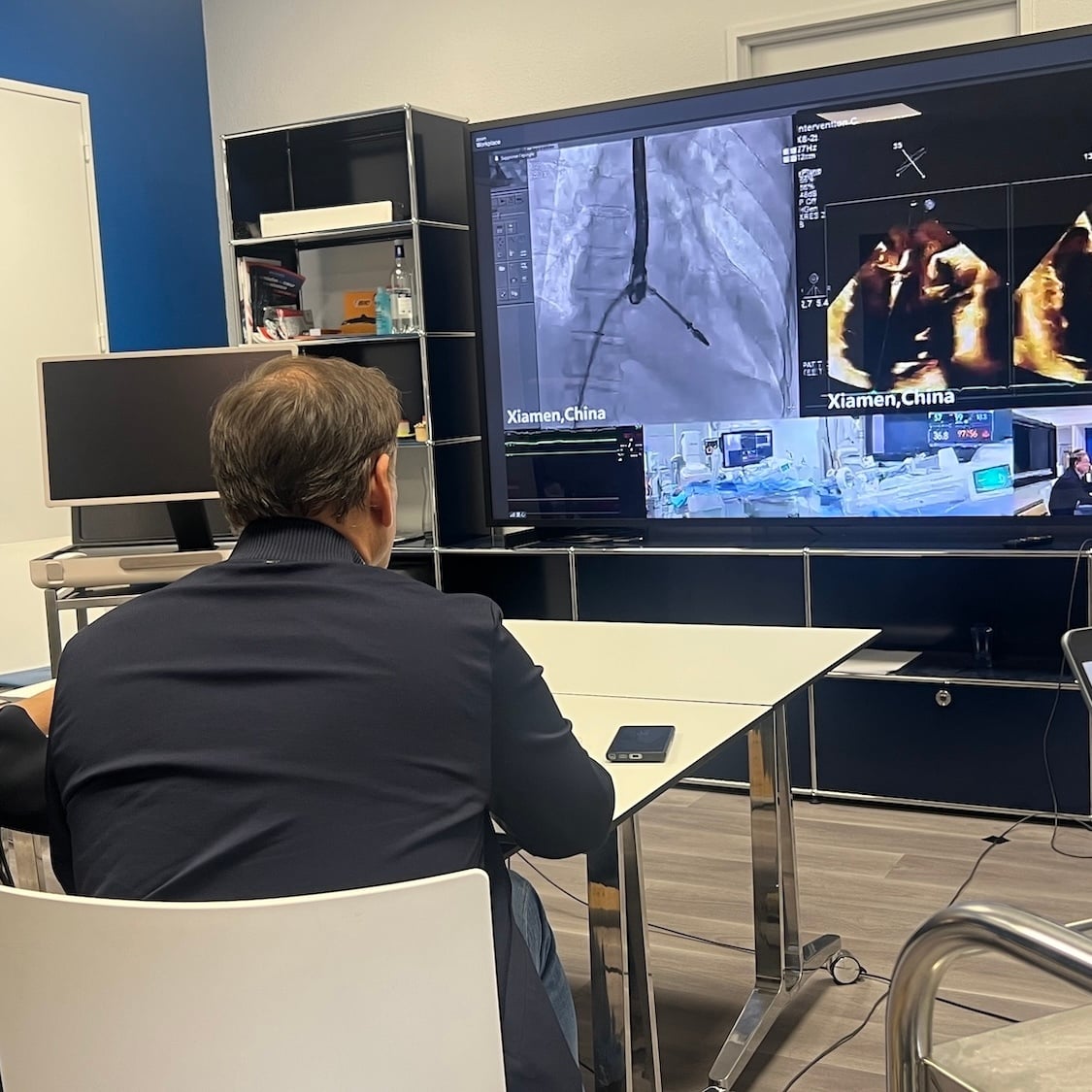 Première mondiale : le CHU de Bordeaux opère à distance un patient en Chine grâce au télépilotage operation-distance-robot