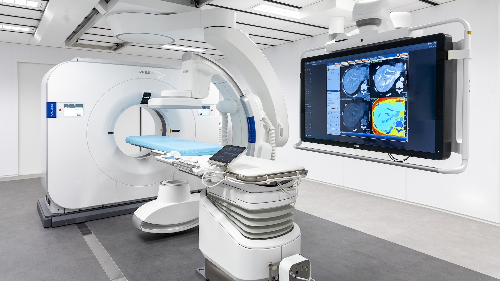 hopital-lyon-sud-technologie-unique-france-cancer