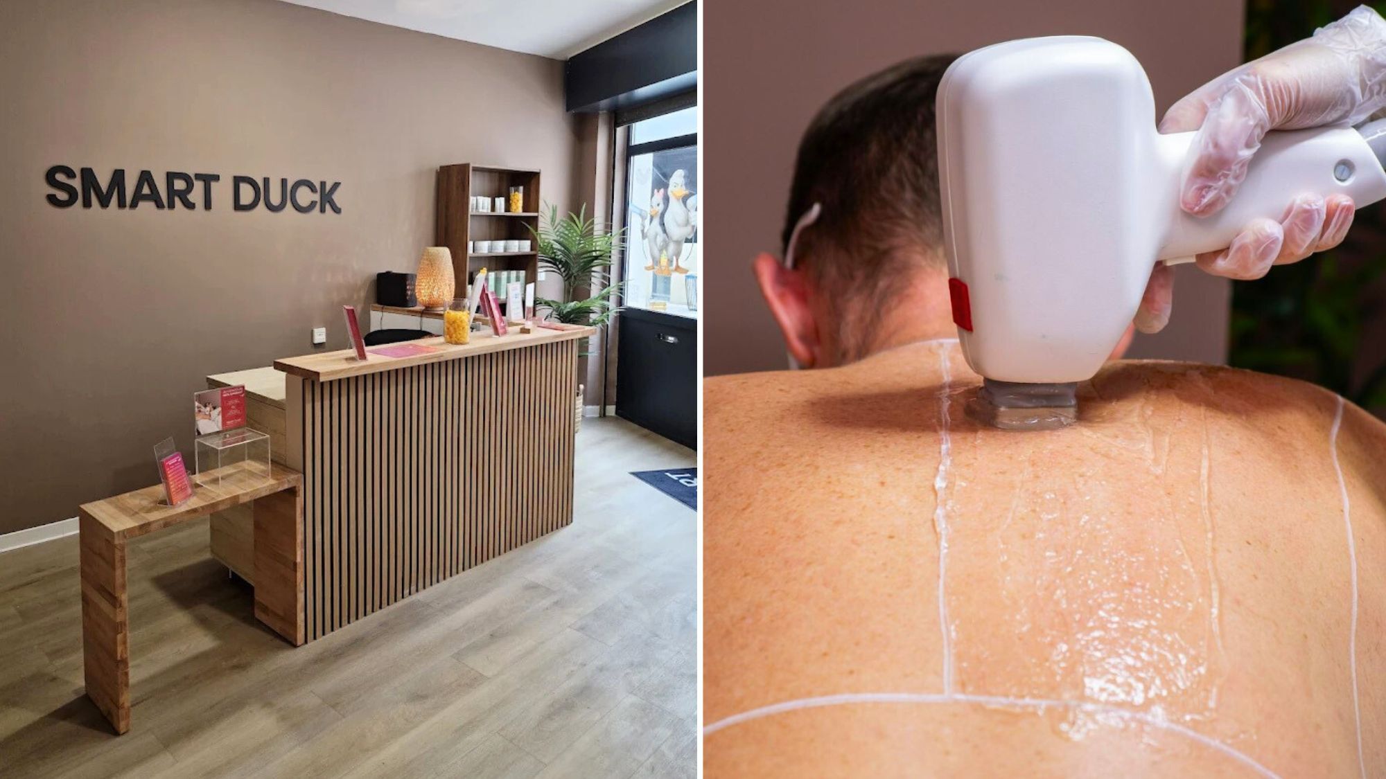 smart-duck-montpellier-laser