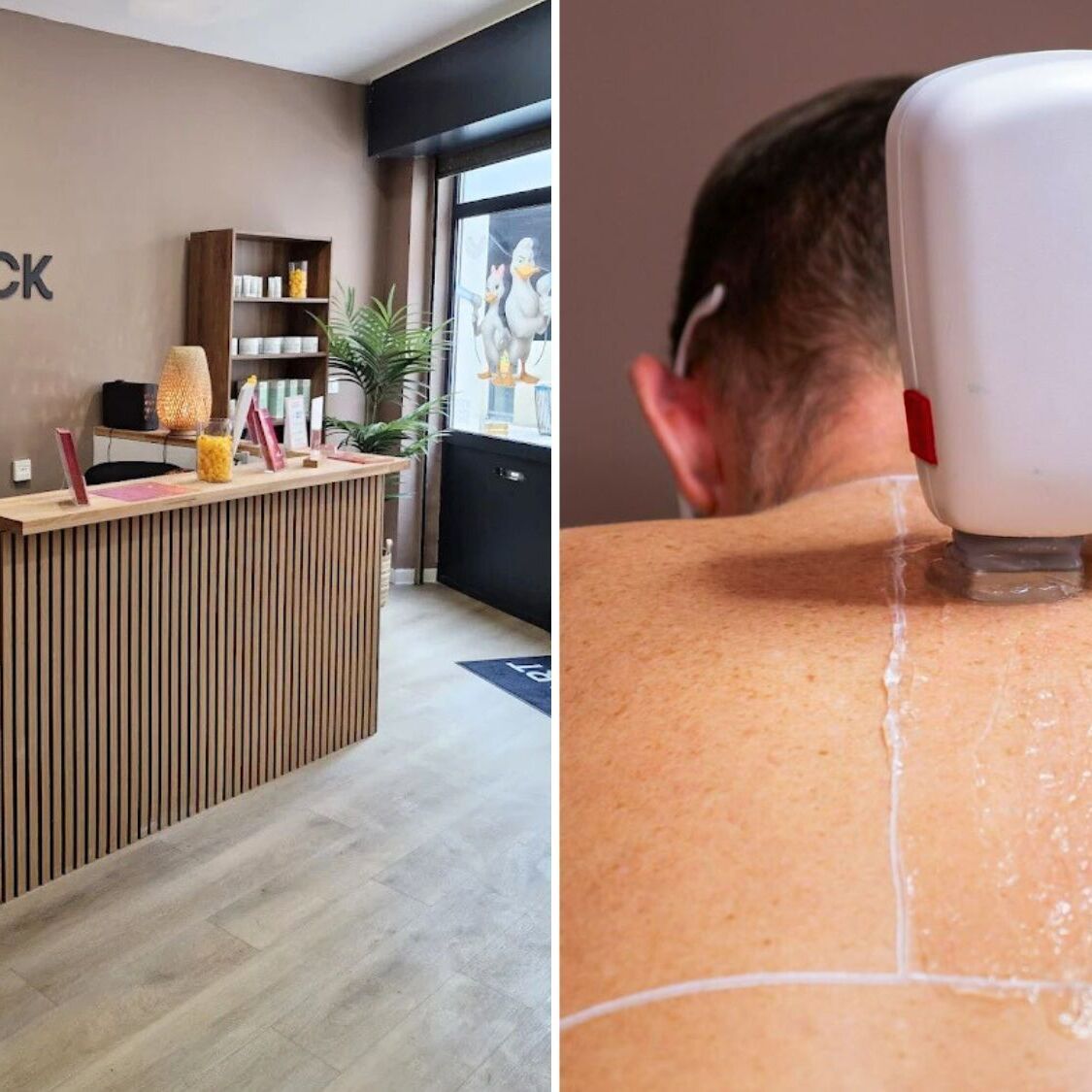 smart-duck-montpellier-laser